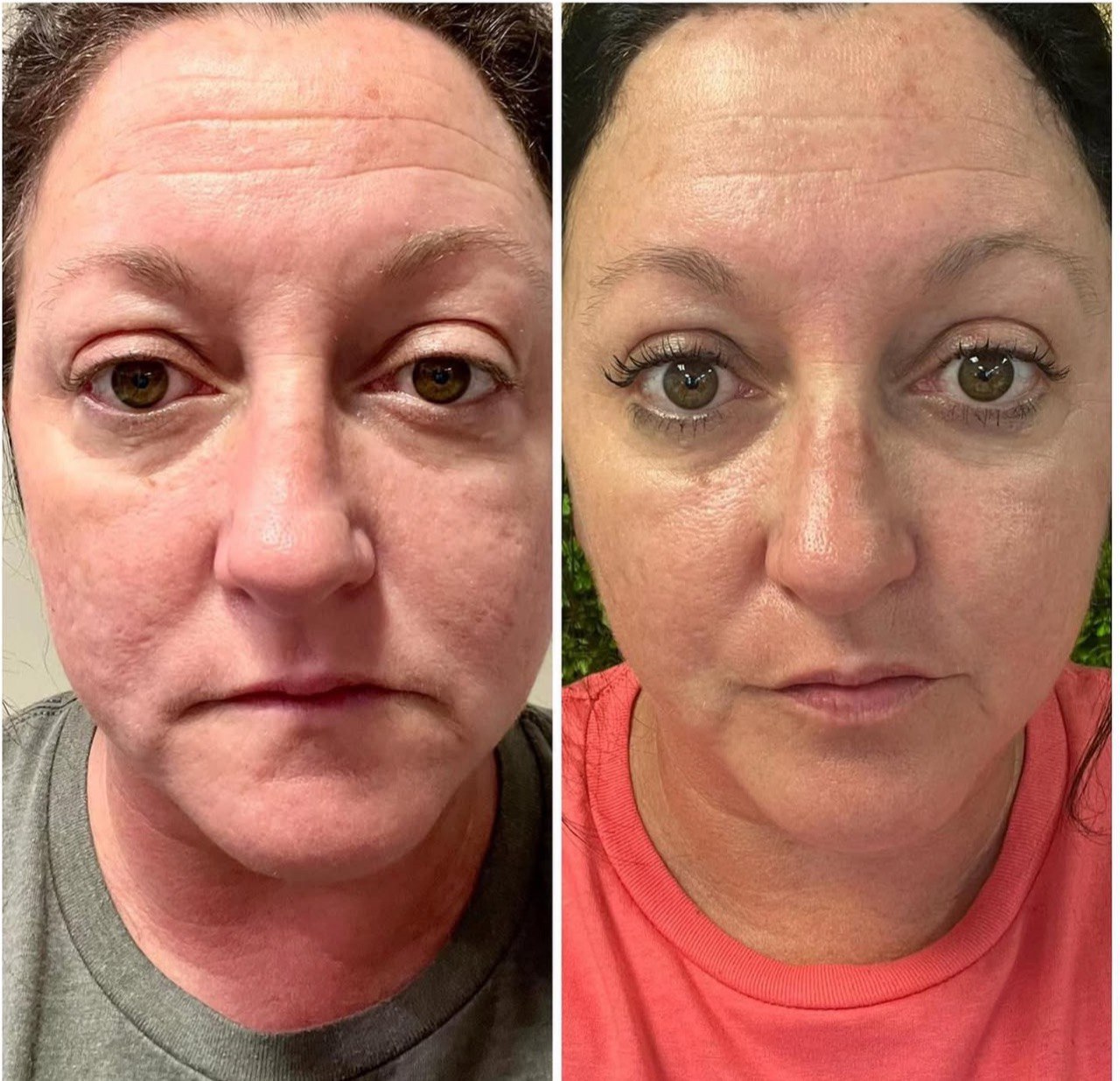 MicroAging™ Astaxanthin Capsules